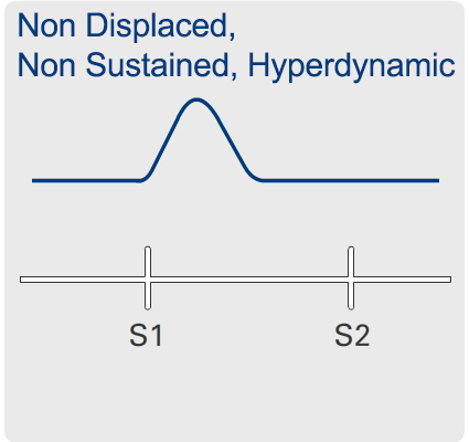 Hyperkinetic