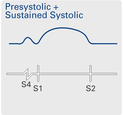 Presystolic + Early Systolic