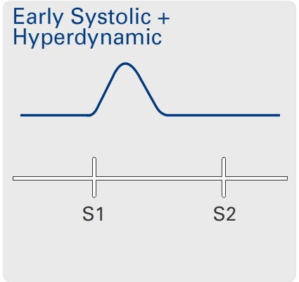 Hyperkinetic