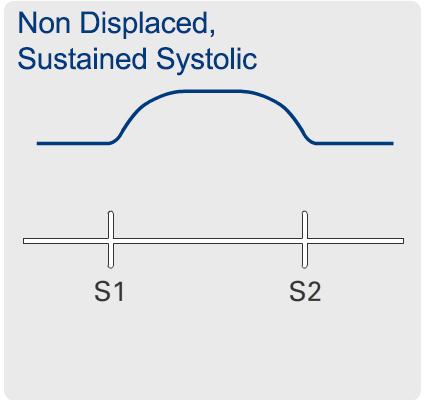 Hyperkinetic